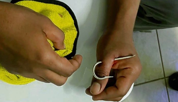 Mata Kail Pancing Menancap di Jari, Nelayan Aceh Besar Minta Bantuan Damkar